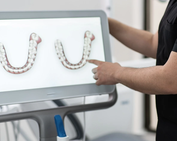 iTero digital scanner for orthodontic impressions